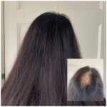 Volumebehandeling vrouw